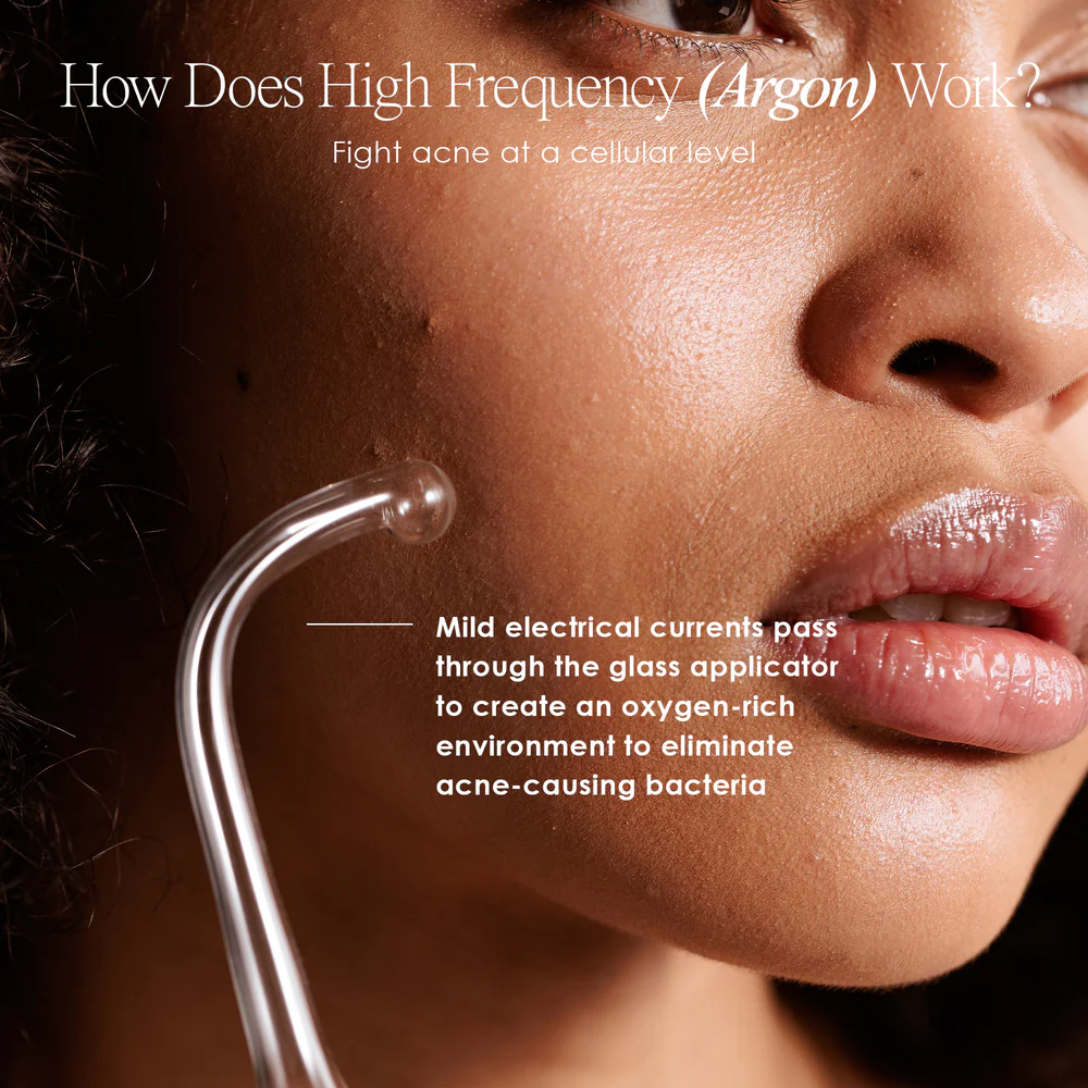 GLOW’s - High Frequency Wand